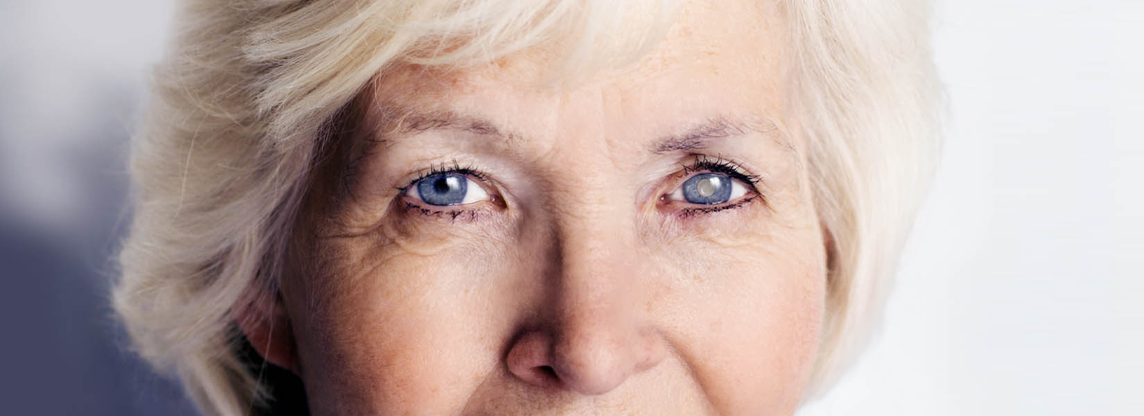 Cataract Surgery in Hendersonville